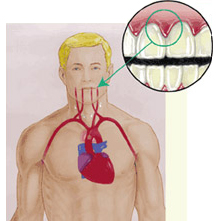 Oral Health Illustration