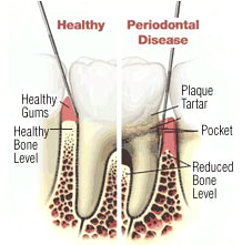 Oral Health Illustration
